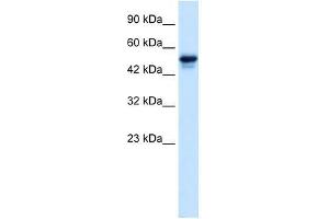 C21ORF18 antibody used at 0. (SETD4 Antikörper  (C-Term))