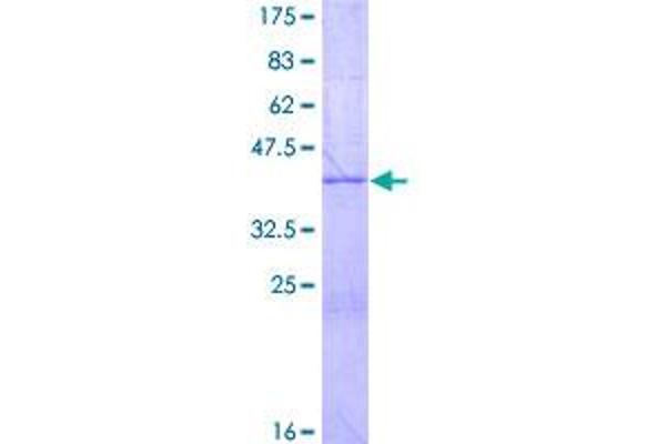 Neuritin 1-Like Protein (NRN1L) (AA 1-165) (GST tag)