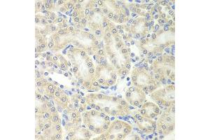 Immunohistochemistry of paraffin-embedded mouse kidney using PRDX5 antibody (ABIN5973743) at dilution of 1/200 (40x lens). (Peroxiredoxin 5 Antikörper)