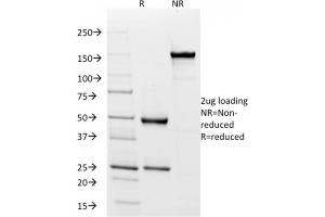 SDS-PAGE (SDS) image for anti-MHC Class II HLA-DP/DQ/DR (HLA-DP/DQ/DR) antibody (ABIN6941388)