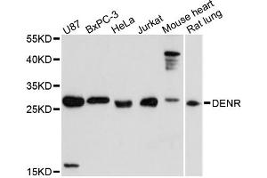 Western blot analysis of extracts of various cell lines, using DENR antibody (ABIN6294200) at 1:3000 dilution. (Density Regulated Protein Antikörper)