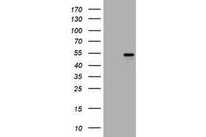 Image no. 1 for anti-Vimentin (VIM) antibody (ABIN1501717) (Vimentin Antikörper)