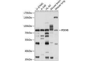 Western blot analysis of extracts of various cell lines, using PDE4B antibody (ABIN6132469, ABIN6145350, ABIN6145351 and ABIN6214353) at 1:1000 dilution. (PDE4B Antikörper  (AA 1-130))