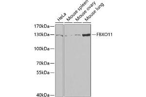 Western blot analysis of extracts of various cell lines, using FBXO11 antibody (ABIN6130885, ABIN6140512, ABIN6140513 and ABIN6221761) at 1:1000 dilution. (FBXO11 Antikörper  (AA 688-927))