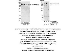 Image no. 1 for anti-Spectrin, Beta, Non-erythrocytic 2 (SPTBN2) (AA 2300-2390), (C-Term) antibody (ABIN363600) (Spectrin, Beta, Non-erythrocytic 2 (SPTBN2) (AA 2300-2390), (C-Term) Antikörper)