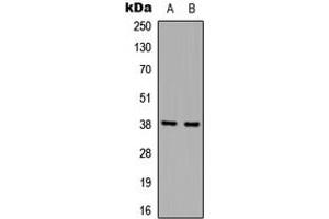 Western blot analysis of hnRNP D0 expression in A431 (A), Jurkat (B) whole cell lysates. (HNRNPD/AUF1 Antikörper  (Center))