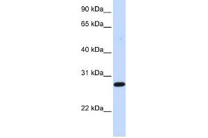 DCK antibody used at 1 ug/ml to detect target protein. (DCK Antikörper  (Middle Region))