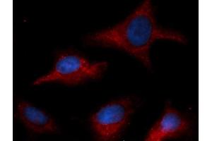 Immunofluorescence (IF) image for anti-Coagulation Factor III (thromboplastin, Tissue Factor) (F3) antibody (APC) (ABIN5567677) (Tissue factor Antikörper  (APC))
