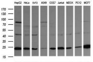 Image no. 5 for anti-RAB21, Member RAS Oncogene Family (RAB21) antibody (ABIN1500542) (RAB21 Antikörper)
