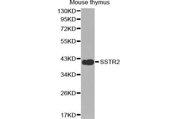 SSTR2 Antikörper  (C-Term)