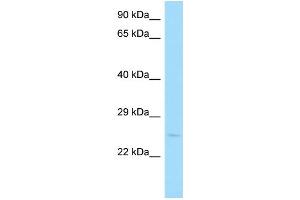 Host: Rabbit Target Name: CD300LB Sample Type: Jurkat Whole Cell lysates Antibody Dilution: 1. (CD300LB Antikörper  (Middle Region))