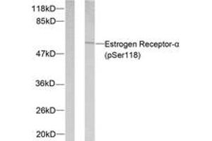 Western blot analysis of extracts from MCF7 cells treated with Estradiol, using Estrogen Receptor-alpha (Phospho-Ser118) Antibody. (Estrogen Receptor alpha Antikörper  (pSer118))