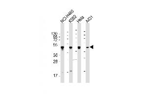 All lanes : Anti-CYK18 Antibody (C-term) at 1:2000 dilution Lane 1: NCI- whole cell lysate Lane 2: K562 whole cell lysate Lane 3: Hela whole cell lysate Lane 4: A431 whole cell lysate Lysates/proteins at 20 μg per lane. (Cytokeratin 18 Antikörper  (C-Term))