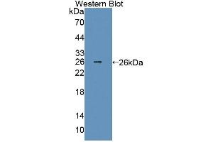 Detection of Recombinant Smad2, Human using Polyclonal Antibody to Mothers Against Decapentaplegic Homolog 2 (Smad2) (SMAD2 Antikörper  (AA 274-467))