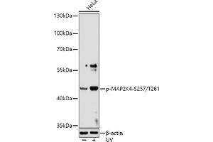 Western blot analysis of extracts of HeLa cells, using Phospho-MK4-S257/T261 antibody (ABIN6135256, ABIN6136136, ABIN6136137 and ABIN6225569) at 1:1000 dilution. (MAP2K4 Antikörper  (pSer257, pThr261))