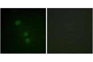 Immunofluorescence analysis of HeLa cells, using Histone H2B (Acetyl-Lys15) Antibody. (Histone H2B Antikörper  (acLys15))