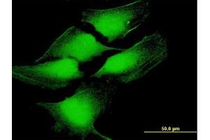 Immunofluorescence of purified MaxPab antibody to TP53 on HeLa cell. (p53 Antikörper  (AA 1-393))