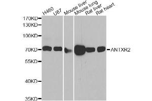 Western blot analysis of extracts of various cell lines, using ANTXR2 antibody (ABIN2561129) at 1:1000 dilution. (ANTXR2 Antikörper)