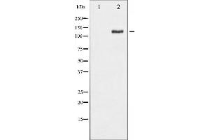Western blot analysis of FAK phosphorylation expression in PMA treated HepG2 whole cell lysates,The lane on the left is treated with the antigen-specific peptide. (FAK Antikörper  (pSer843))