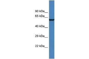 Western Blotting (WB) image for anti-Adhesion Molecule with Ig-Like Domain 2 (AMIGO2) (N-Term) antibody (ABIN2156368) (AMIGO2 Antikörper  (N-Term))
