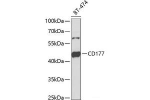 Western blot analysis of extracts of BT-474 cells using CD177 Polyclonal Antibody at dilution of 1:1000. (CD177 Antikörper)