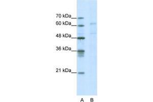 Western Blotting (WB) image for anti-Calcium Channel, Voltage-Dependent, beta 3 Subunit (CACNB3) antibody (ABIN2461082) (CACNB3 Antikörper)