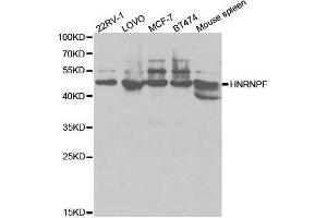 Western blot analysis of extracts of various cell lines, using HNRNPF antibody. (HNRNPF Antikörper  (AA 1-280))