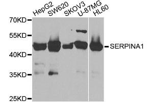 Western blot analysis of extracts of various cell lines, using SERPINA1 antibody. (SERPINA1 Antikörper)
