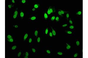 Immunofluorescence staining of Hela cells with ABIN7127304 at 1:60,counter-stained with DAPI. (Rekombinanter HIST1H3A Antikörper  (H3R2me))