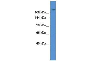 Western Blot showing TPR antibody used at a concentration of 1 ug/ml against 721_B Cell Lysate (TPR Antikörper  (C-Term))