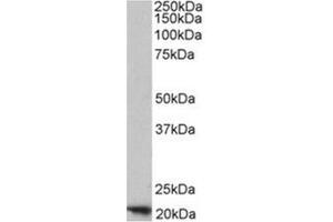 Image no. 1 for anti-Ferritin, Heavy Polypeptide 1 (FTH1) (C-Term), (Heavy Chain) antibody (ABIN375067) (FTH1 Antikörper  (C-Term, Heavy Chain))