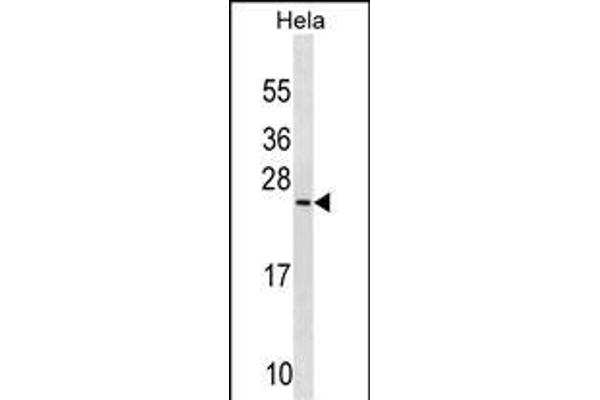 PRELID1 Antikörper  (N-Term)