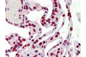 Immunohistochemistry of Histone H3 antibody Tissue: Lung Fixation: formalin fixed paraffin embedded Antigen retrieval: user optimized Primary antibody:  Histone H3 antibody 1:100 Secondary antibody: Peroxidase goat anti-rabbit at 1:10,000 for 45 min at RT Image provided courtesy of Andrew Elston, LifeSpan BioSciences, Inc. (Histone 3 Antikörper  (C-Term))