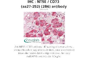Image no. 1 for anti-5'-Nucleotidase, Ecto (CD73) (NT5E) (AA 27-252) antibody (ABIN1723204) (CD73 Antikörper  (AA 27-252))