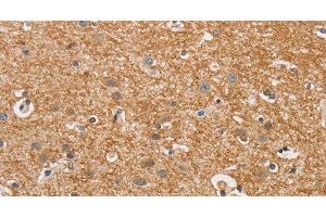 Immunohistochemistry of paraffin-embedded Human brain using CYP4A11 Polyclonal Antibody at dilution of 1:30 (CYP4A11 Antikörper)