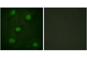 Immunofluorescence analysis of HeLa cells, using p53 (Ab-317) Antibody. (p53 Antikörper  (AA 283-332))