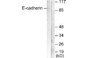 Western blot analysis of extracts from 293 cells, using E-cadherin antibody. (E-cadherin Antikörper)