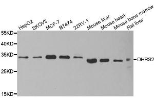 Western blot analysis of extracts of various cell lines, using DHRS2 antibody (ABIN5973846) at 1/1000 dilution. (DHRS2 Antikörper)