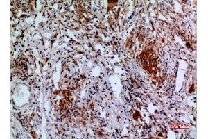 Immunohistochemical analysis of paraffin-embedded human-lung, antibody was diluted at 1:100. (APAF1 Antikörper  (Internal Region))