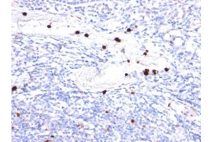 Formalin-fixed, paraffin-embedded human Tonsil stained with G-CSF Mouse Monoclonal Antibody (CSF3/900). (G-CSF Antikörper)