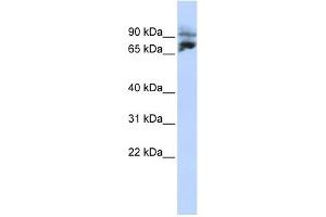 KIF2A antibody used at 1 ug/ml to detect target protein. (KIF2A Antikörper  (N-Term))