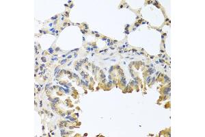 Immunohistochemistry of paraffin-embedded mouse lung using Bax antibody (ABIN5970040) at dilution of 1/100 (40x lens). (BAX Antikörper)