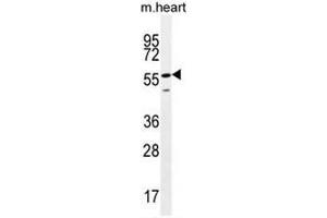 SMTNL2 Antibody (N-term) western blot analysis in mouse heart tissue lysates (35µg/lane). (SMTNL2 Antikörper  (N-Term))