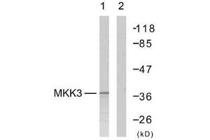 Western blot analysis of extract from MDA-MB-435 cells, using MKK3 (Ab-189) antibody (E021116). (MAP2K3 Antikörper)