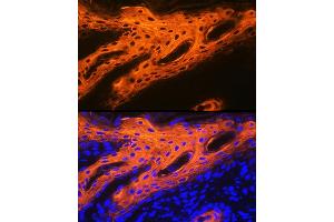 Immunofluorescence analysis of human skin using Cytokeratin 2e (KRT2) Rabbit mAb (ABIN1680763, ABIN3016322, ABIN3016323 and ABIN7101480) at dilution of 1:100 (40x lens). (Keratin 2 Antikörper)