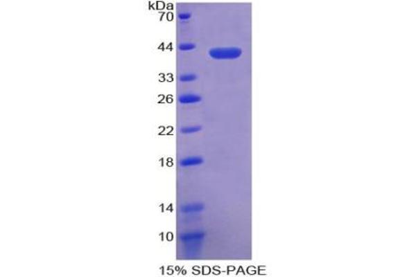 CRYL1 Protein