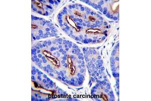 Immunohistochemistry (IHC) image for anti-Folate Hydrolase (Prostate-Specific Membrane Antigen) 1 (FOLH1) antibody (ABIN2997484) (PSMA Antikörper)