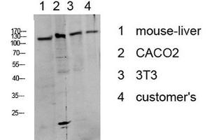 Western Blot analysis of various cells using Phospho-DDR1 (Tyr513) Polyclonal Antibody at dilution of 1:1000. (DDR1 Antikörper  (pTyr513))