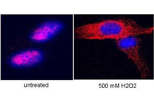 Anti-hTERT Antibody - Immunofluorescence Microscopy  anti hTERT antibody-Immunofluorescence# anti hTERT antibody was used to stain hTERT on hTERT-over-expressing fibroblasts. (TERT Antikörper  (C-Term))