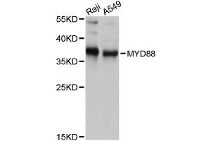 Western blot analysis of extracts of various cell lines, using MYD88 antibody. (MYD88 Antikörper)
